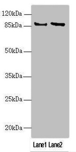 MAPK8IP2 / JIP2 Antibody - Western blot All Lanes: MAPK8IP2 antibody at 2.85 ug/ml Lane 1: U251 whole cell lysate Lane 2: A549 whole cell lysate Secondary Goat polyclonal to rabbit IgG at 1/10000 dilution Predicted band size: 88,85,65,50 kDa Observed band size: 88 kDa