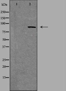 MAPK8IP2 / JIP2 Antibody - Western blot analysis of extracts of mouse brain cells using JIP2 antibody. The lane on the left is treated with the antigen-specific peptide.
