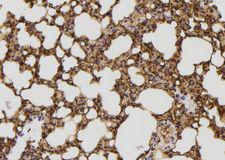 MAPK8IP2 / JIP2 Antibody - 1:100 staining mouse lung tissue by IHC-P. The sample was formaldehyde fixed and a heat mediated antigen retrieval step in citrate buffer was performed. The sample was then blocked and incubated with the antibody for 1.5 hours at 22°C. An HRP conjugated goat anti-rabbit antibody was used as the secondary.