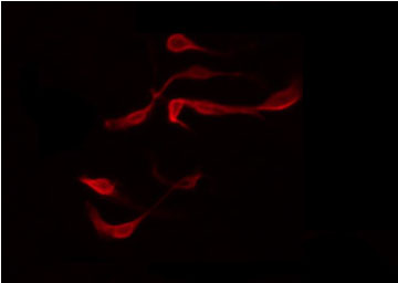 MAPK8IP2 / JIP2 Antibody - Staining U87 cells by IF/ICC. The samples were fixed with PFA and permeabilized in 0.1% Triton X-100, then blocked in 10% serum for 45 min at 25°C. The primary antibody was diluted at 1:200 and incubated with the sample for 1 hour at 37°C. An Alexa Fluor 594 conjugated goat anti-rabbit IgG (H+L) Ab, diluted at 1/600, was used as the secondary antibody.