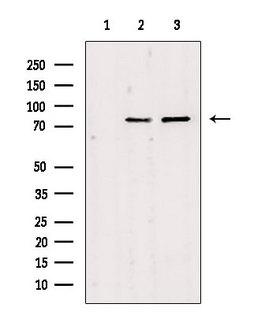 MAPK8IP2 / JIP2 Antibody - Western blot analysis of extracts of various samples using JIP2 antibody. Lane 1: HepG2 treated with antigen-specific peptide; Lane 2: HepG2; Lane 3: HeLa;