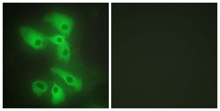 MAPK8IP2 / JIP2 Antibody - Peptide - + Immunofluorescence analysis of HeLa cells, using JIP2 antibody.