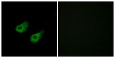 MAPK8IP3 / JIP3 Antibody - Immunofluorescence analysis of HeLa cells, using JIP3 Antibody. The picture on the right is blocked with the synthesized peptide.