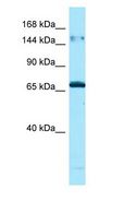 MAPK8IP3 / JIP3 Antibody - MAPK8IP3 / JIP3 antibody Western Blot of Placenta.  This image was taken for the unconjugated form of this product. Other forms have not been tested.