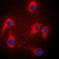 MAPK8IP3 / JIP3 Antibody - Immunofluorescent analysis of JIP3 staining in PC12 cells. Formalin-fixed cells were permeabilized with 0.1% Triton X-100 in TBS for 5-10 minutes and blocked with 3% BSA-PBS for 30 minutes at room temperature. Cells were probed with the primary antibody in 3% BSA-PBS and incubated overnight at 4 C in a humidified chamber. Cells were washed with PBST and incubated with a DyLight 594-conjugated secondary antibody (red) in PBS at room temperature in the dark. DAPI was used to stain the cell nuclei (blue).