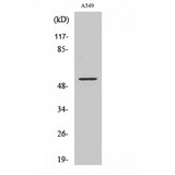 MAPK9 / JNK2 Antibody - Western blot of JNK2 antibody