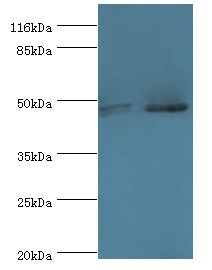 MAPK9 / JNK2 Antibody - Western blot. All lanes: MAPK9 antibody at 2 ug/ml. Lane 1: HeLa whole cell lysate Lane 2: mouse brain tissue. Secondary antibody: goat polyclonal to rabbit at 1:10000 dilution. Predicted band size: 48 kDa. Observed band size: 48 kDa.  This image was taken for the unconjugated form of this product. Other forms have not been tested.