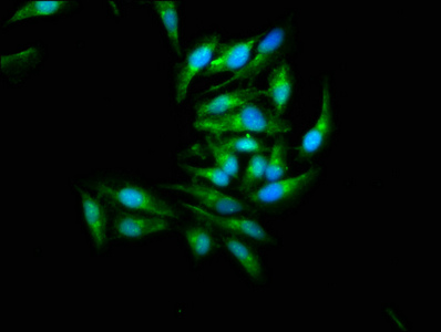 MAPK9 / JNK2 Antibody - Immunofluorescence staining of Hela cells with MAPK9 Antibody at 1:266, counter-stained with DAPI. The cells were fixed in 4% formaldehyde, permeabilized using 0.2% Triton X-100 and blocked in 10% normal Goat Serum. The cells were then incubated with the antibody overnight at 4°C. The secondary antibody was Alexa Fluor 488-congugated AffiniPure Goat Anti-Rabbit IgG(H+L).
