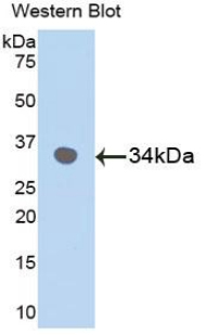 MAPK9 / JNK2 Antibody - Western blot of recombinant MAPK9 / JNK2 / SAPK.  This image was taken for the unconjugated form of this product. Other forms have not been tested.