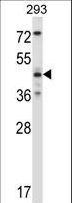 MAPK9 / JNK2 Antibody - Mouse Mapk9 Antibody western blot of 293 cell line lysates (35 ug/lane). The Mapk9 antibody detected the Mapk9 protein (arrow).