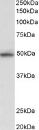 MAPK9 / JNK2 Antibody - MAPK9 antibody (0.03 ug/ml) staining of HeLa lysate (35 ug protein in RIPA buffer). Primary incubation was 1 hour. Detected by chemiluminescence.