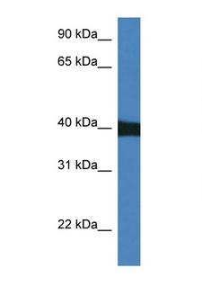 MAPK9 / JNK2 Antibody - MAPK9 / JNK2 antibody Western blot of Mouse Heart lysate. Antibody concentration 1 ug/ml. This image was taken for the unconjugated form of this product. Other forms have not been tested.