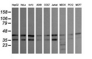 MAPK9 / JNK2 Antibody - Western blot of extracts (35 ug) from 9 different cell lines by using g anti-MAPK9 monoclonal antibody (HepG2: human; HeLa: human; SVT2: mouse; A549: human; COS7: monkey; Jurkat: human; MDCK: canine; PC12: rat; MCF7: human).