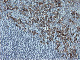 MAPK9 / JNK2 Antibody - IHC of paraffin-embedded Human tonsil using anti-MAPK9 mouse monoclonal antibody.