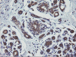 MAPK9 / JNK2 Antibody - IHC of paraffin-embedded Human breast tissue using anti-MAPK9 mouse monoclonal antibody.