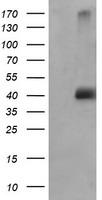 MAPK9 / JNK2 Antibody - HEK293T cells were transfected with the pCMV6-ENTRY control (Left lane) or pCMV6-ENTRY MAPK9 (Right lane) cDNA for 48 hrs and lysed. Equivalent amounts of cell lysates (5 ug per lane) were separated by SDS-PAGE and immunoblotted with anti-MAPK9.