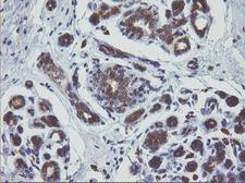MAPK9 / JNK2 Antibody - IHC of paraffin-embedded Human breast tissue using anti-MAPK9 mouse monoclonal antibody.