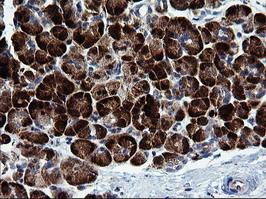 MAPK9 / JNK2 Antibody - IHC of paraffin-embedded Human pancreas tissue using anti-MAPK9 mouse monoclonal antibody.