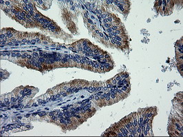 MAPK9 / JNK2 Antibody - IHC of paraffin-embedded Human prostate tissue using anti-MAPK9 mouse monoclonal antibody.