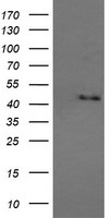 MAPK9 / JNK2 Antibody - HEK293T cells were transfected with the pCMV6-ENTRY control (Left lane) or pCMV6-ENTRY MAPK9 (Right lane) cDNA for 48 hrs and lysed. Equivalent amounts of cell lysates (5 ug per lane) were separated by SDS-PAGE and immunoblotted with anti-MAPK9.