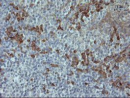 MAPK9 / JNK2 Antibody - IHC of paraffin-embedded Human tonsil using anti-MAPK9 mouse monoclonal antibody.