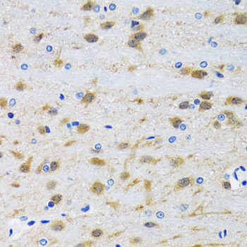 MAPK9 / JNK2 Antibody - Immunohistochemistry of paraffin-embedded mouse brain using MAPK9 antibodyat dilution of 1:100 (40x lens).