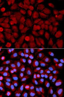 MAPK9 / JNK2 Antibody - Immunofluorescence analysis of U2OS cells using MAPK9 antibody. Blue: DAPI for nuclear staining.