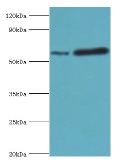 MAPKAP1 / MIP1 Antibody - Western blot. All lanes: Target of rapamycin complex 2 subunit MAPKAP1 antibody at 2 ug/ml. Lane 1: HeLa whole cell lysate. Lane 2: MCF-7 whole cell lysate. secondary Goat polyclonal to rabbit at 1:10000 dilution. Predicted band size: 59 kDa. Observed band size: 59 kDa.