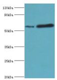 MAPKAP1 / MIP1 Antibody - Western blot. All lanes: Target of rapamycin complex 2 subunit MAPKAP1 antibody at 2 ug/ml. Lane 1: HeLa whole cell lysate. Lane 2: MCF-7 whole cell lysate. secondary Goat polyclonal to rabbit at 1:10000 dilution. Predicted band size: 59 kDa. Observed band size: 59 kDa.