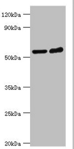 MAPKAP1 / MIP1 Antibody - Western blot All lanes: Target of rapamycin complex 2 subunit MAPKAP1 antibody at 2µg/ml Lane 1: Hela whole cell lysate Lane 2: MCF-7 whole cell lysate Secondary Goat polyclonal to rabbit IgG at 1/10000 dilution Predicted band size: 60, 55, 54, 38, 37, 42 kDa Observed band size: 60 kDa