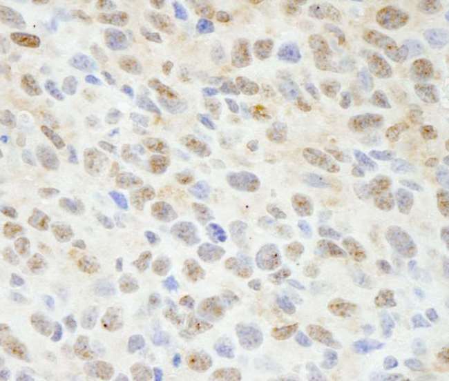 MAPKAP1 / MIP1 Antibody - Detection of Mouse Sin1 by Immunohistochemistry. Sample: FFPE section of mouse squamous cell carcinoma. Antibody: Affinity purified rabbit anti-Sin1 used at a dilution of 1:100.