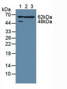 MAPKAPK2 / MAPKAP Kinase 2 Antibody - Western Blot; Sample: Lane1: Human Hela Cells; Lane2: Human A549 Cells; Lane3: Mouse Large Intestine Tissue.