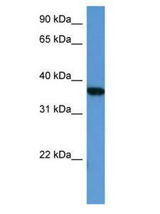 MAPKAPK2 / MAPKAP Kinase 2 Antibody - MAPKAPK2 / MK2 antibody Western Blot of HepG2 cell lysate.  This image was taken for the unconjugated form of this product. Other forms have not been tested.