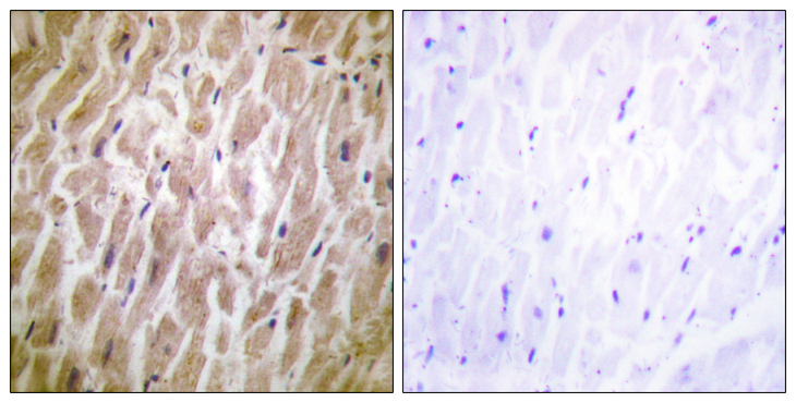 MAPKAPK2 / MAPKAP Kinase 2 Antibody - Immunohistochemistry analysis of paraffin-embedded human heart tissue, using MAPKAPK2 Antibody. The picture on the right is blocked with the synthesized peptide.
