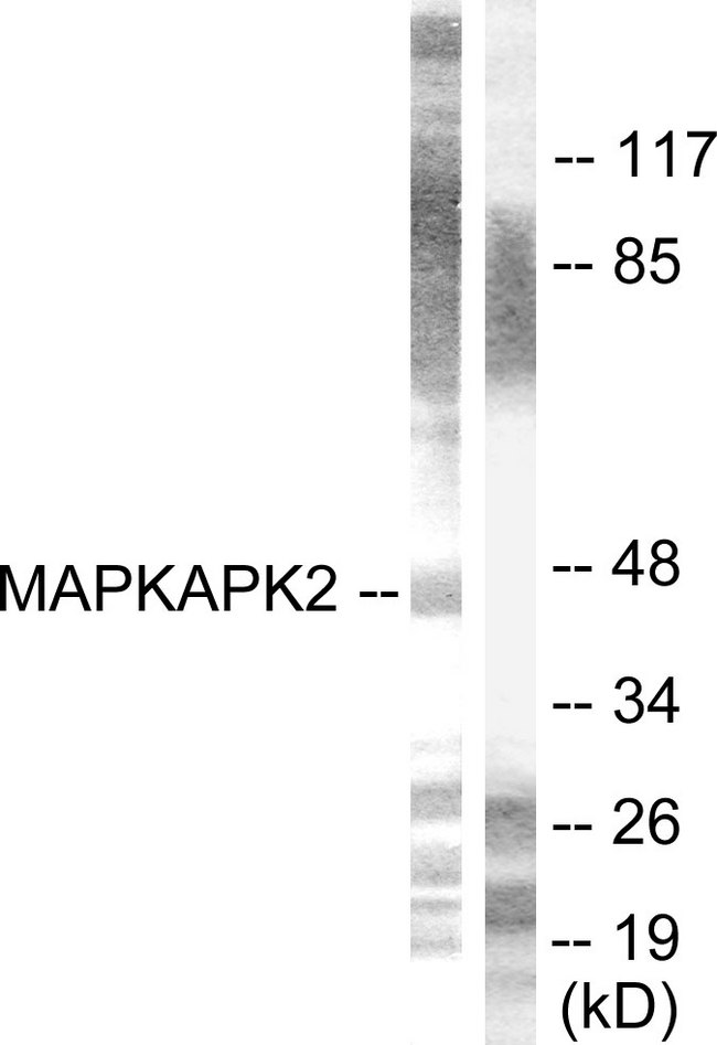 MAPKAPK2 / MAPKAP Kinase 2 Antibody - Western blot analysis of lysates from HeLa cells, treated with Ca2+ 40nM 30', using MAPKAPK2 Antibody. The lane on the right is blocked with the synthesized peptide.