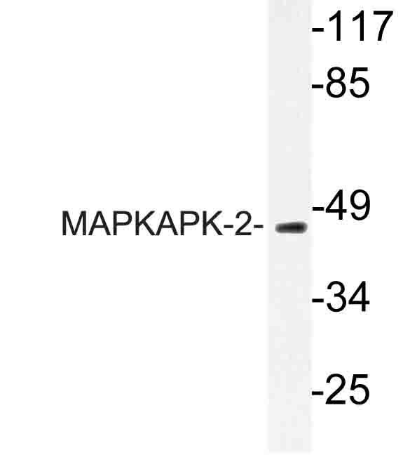 MAPKAPK2 / MAPKAP Kinase 2 Antibody - Western blot of MAPKAPK-2 (N218) pAb in extracts from HUVEC cells.