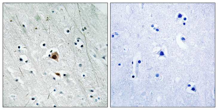 MAPKAPK2 / MAPKAP Kinase 2 Antibody - Immunohistochemistry analysis of paraffin-embedded human brain, using MAPKAPK2 (Phospho-Ser272) Antibody. The picture on the right is blocked with the phospho peptide.
