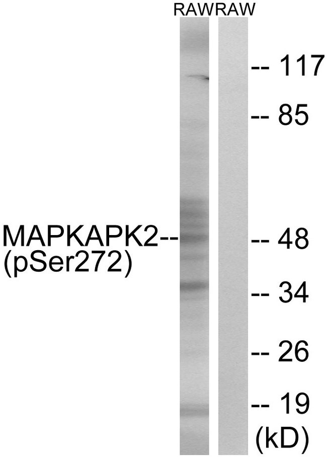 MAPKAPK2 / MAPKAP Kinase 2 Antibody - Western blot analysis of lysates from RAW264.7 cells treated with UV 15', using MAPKAPK2 (Phospho-Ser272) Antibody. The lane on the right is blocked with the phospho peptide.