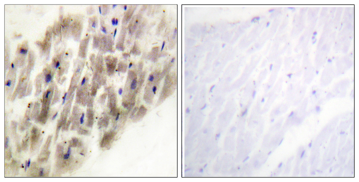 MAPKAPK2 / MAPKAP Kinase 2 Antibody - Immunohistochemistry analysis of paraffin-embedded human heart, using MAPKAPK-2 (Phospho-Thr222) Antibody. The picture on the right is blocked with the phospho peptide.