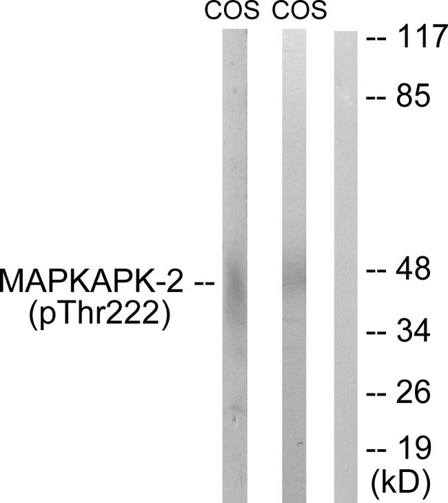 MAPKAPK2 / MAPKAP Kinase 2 Antibody - Western blot analysis of lysates from COS7 cells treated with UV 15', using MAPKAPK-2 (Phospho-Thr222) Antibody. The lane on the right is blocked with the phospho peptide.