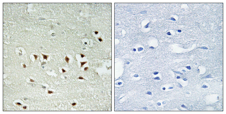 MAPKAPK2 / MAPKAP Kinase 2 Antibody - Immunohistochemistry analysis of paraffin-embedded human brain, using MAPKAPK2 (Phospho-Thr334) Antibody. The picture on the right is blocked with the phospho peptide.