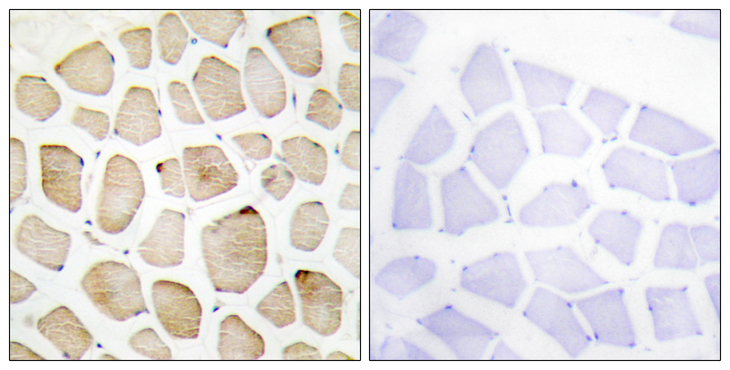 MAPKAPK3 Antibody - Immunohistochemistry analysis of paraffin-embedded human skeletal muscle tissue, using MAPK3 Antibody. The picture on the right is blocked with the synthesized peptide.