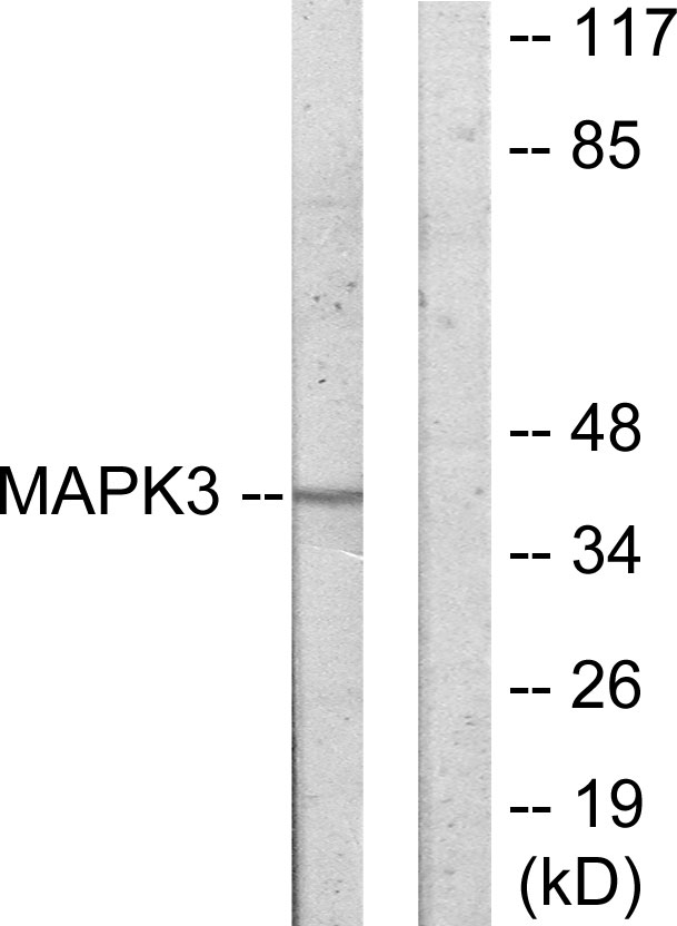 MAPKAPK3 Antibody - Western blot analysis of lysates from COLO205 cells, using MAPK3 Antibody. The lane on the right is blocked with the synthesized peptide.