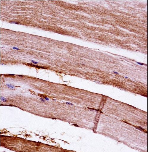 MAPKAPK3 Antibody - Mouse Mapkapk3 Antibody immunohistochemistry of formalin-fixed and paraffin-embedded mouse skeletal muscle followed by peroxidase-conjugated secondary antibody and DAB staining.This data demonstrates the use of Mouse Mapkapk3 Antibody for immunohistochemistry.