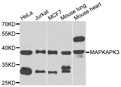 MAPKAPK3 Antibody - Western blot analysis of extracts of various cell lines.