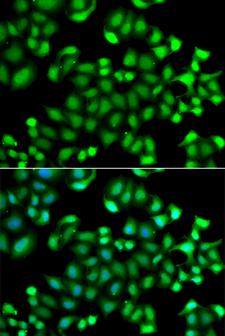 MAPKAPK3 Antibody - Immunofluorescence analysis of A549 cells.