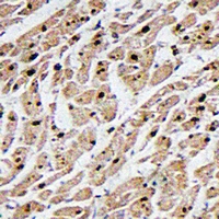 MAPKAPK3 Antibody - Immunohistochemical analysis of MAPKAPK3 staining in human heart formalin fixed paraffin embedded tissue section. The section was pre-treated using heat mediated antigen retrieval with sodium citrate buffer (pH 6.0). The section was then incubated with the antibody at room temperature and detected with HRP and DAB as chromogen. The section was then counterstained with hematoxylin and mounted with DPX.