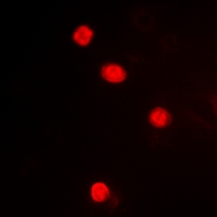 MAPKAPK3 Antibody - Immunofluorescent analysis of MAPKAPK3 staining in HeLa cells. Formalin-fixed cells were permeabilized with 0.1% Triton X-100 in TBS for 5-10 minutes and blocked with 3% BSA-PBS for 30 minutes at room temperature. Cells were probed with the primary antibody in 3% BSA-PBS and incubated overnight at 4 deg C in a humidified chamber. Cells were washed with PBST and incubated with a DyLight 594-conjugated secondary antibody (red) in PBS at room temperature in the dark. DAPI was used to stain the cell nuclei (blue).