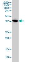 MAPKAPK3 Antibody - MAPKAPK3 monoclonal antibody (M02), clone 2B5 Western blot of MAPKAPK3 expression in HeLa.