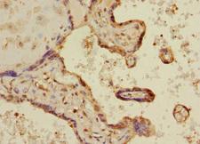 MAPKAPK3 Antibody - Immunohistochemistry of paraffin-embedded human placenta tissue at dilution 1:100